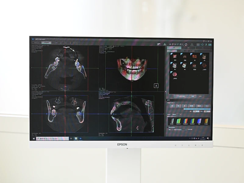 精密診断と低侵襲な治療1