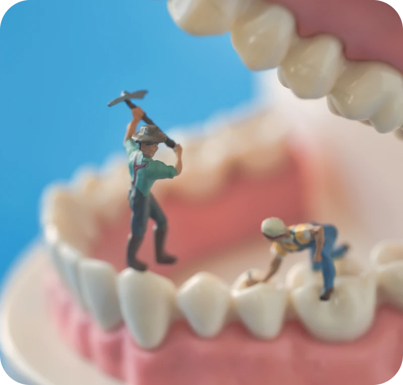 歯周病チェック